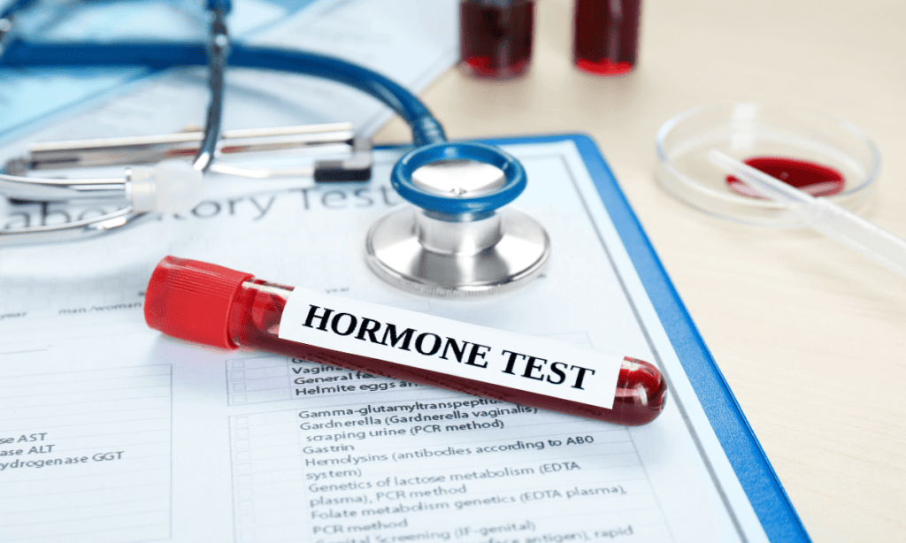 Medical Tests For Men